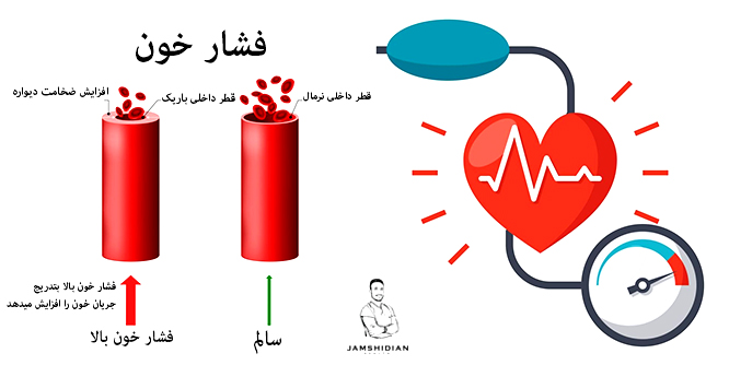 پیشگیری از فشار خون
