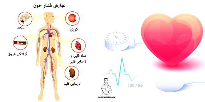 عوارض فشار خون:سکته،گرفتگی عروق،کوری،حمله قلبی ونارسایی قلبی،نارسایی کلیه