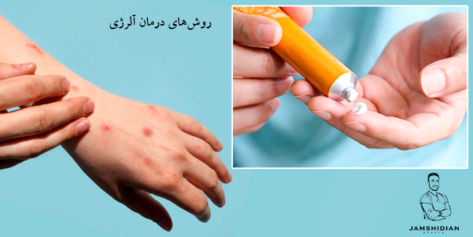 روش های درمان آلرژی