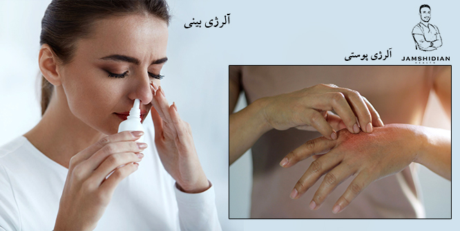 آلرژی پوستی/آلرژی بینی