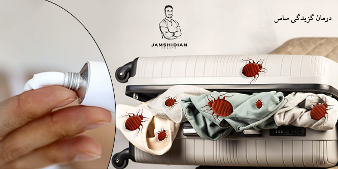 درمان گزیدگی ساس