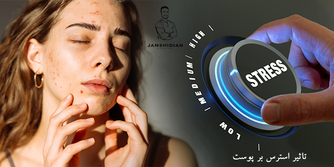 تاثیر استرس بر پوست